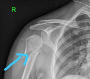 798-d06b35cc345feeb08198bf9e0a418b7a_prev